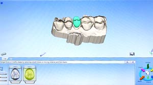 CFAO2 - Polyclinique dentaire Européenne - Tours - Région Centre - Spécialités dentaires