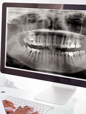 Innovations technologiques - radilogie 3D - Polyclinique dentaire Européenne Tours- Spécialités dentaires à Tours