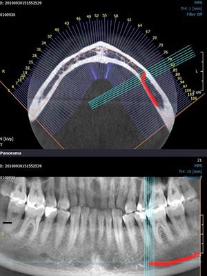 Innovations technologiques - radilogie 3D - Polyclinique dentaire Européenne Tours- Spécialités dentaires à Tours