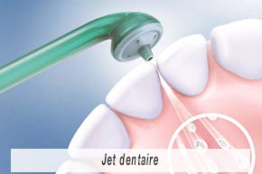 Maladies parodontales Implantologie - Polyclinique dentaire Européenne - Tours - Région Centre - Spécialités dentaires