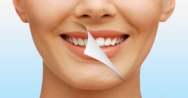 plaque dentaire - Polyclinique dentaire Européenne - Tours - Région Centre - Spécialités dentaires