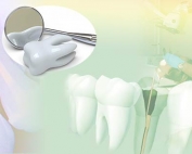 Ondodontie - Polyclinique dentaire Européenne Tours- Spécialités dentaires à Tours